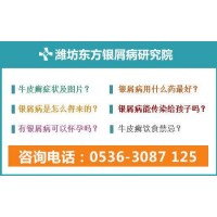 濰坊看銀屑病專業(yè)的療法